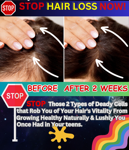 hair loss treatment Solution